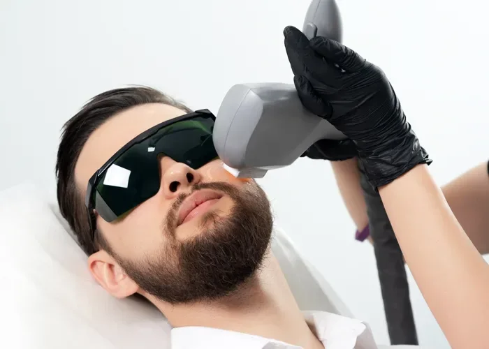 Erkek Lazer Epilasyon Nedir? Nasıl Yapılır?